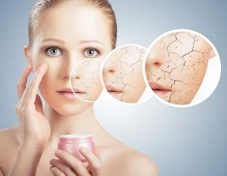 Una buona crema idratante evita la disidratazione della pelle