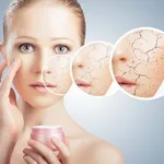 Una buona crema idratante evita la disidratazione della pelle