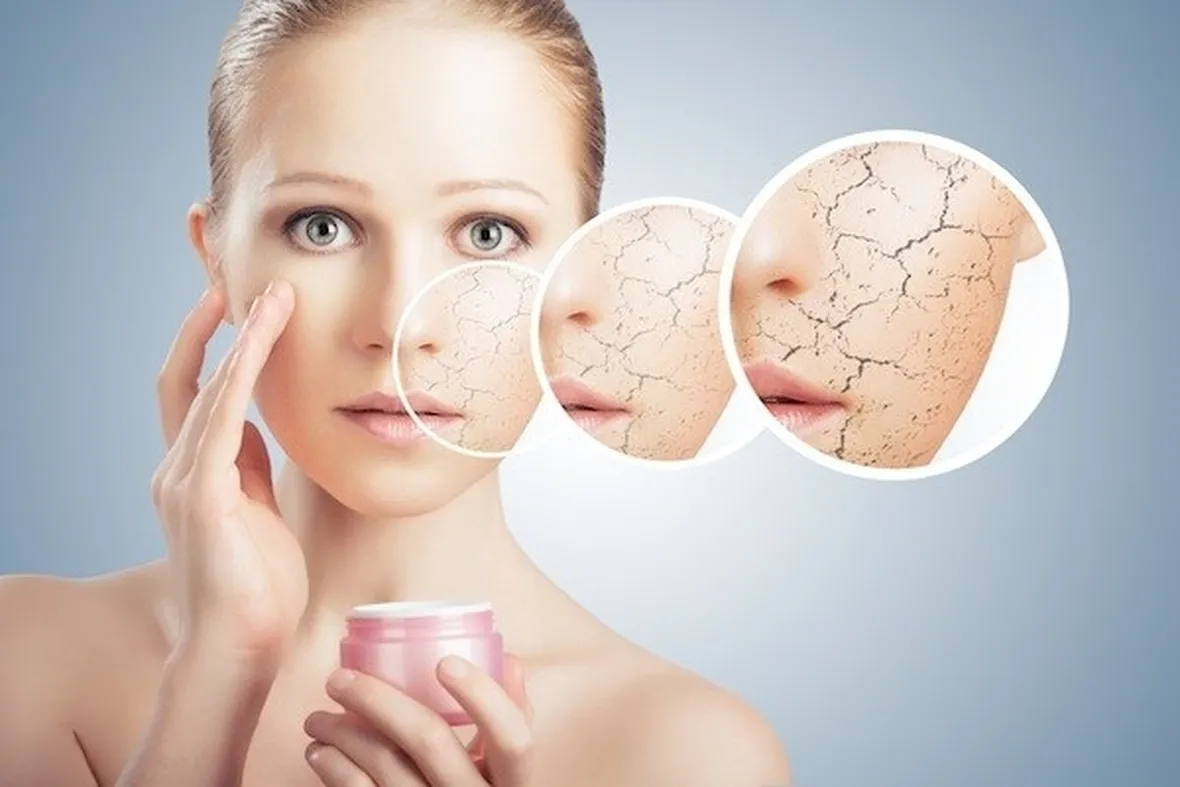 Una buona crema idratante evita la disidratazione della pelle