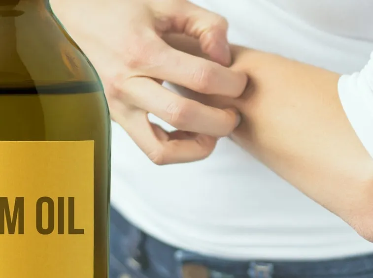 olio di neem